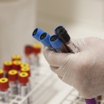 Landspítali blood tests