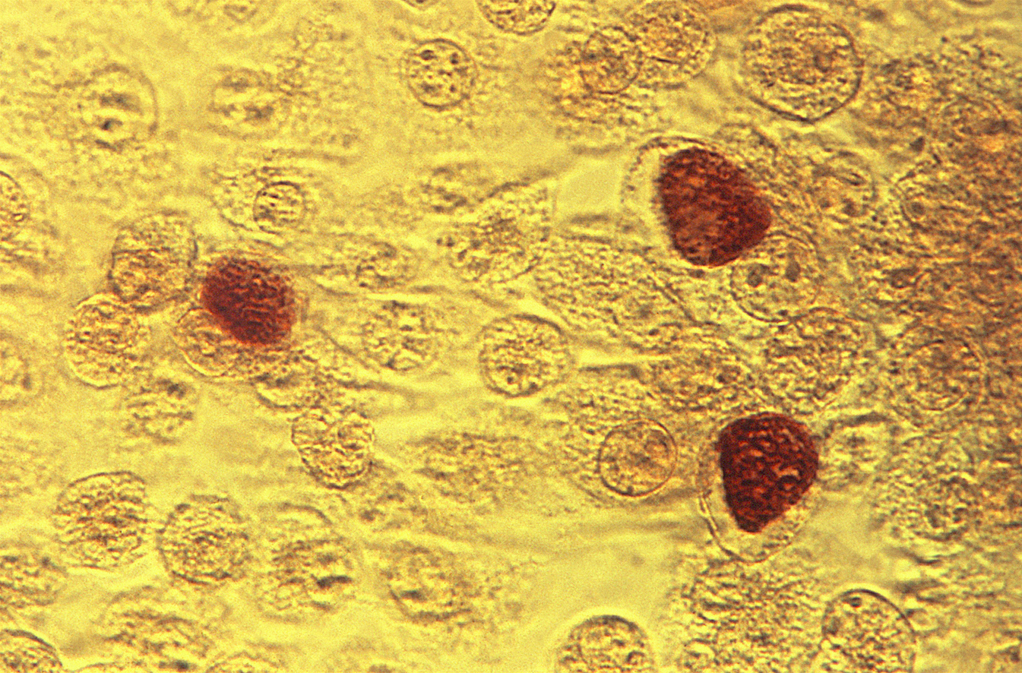 What Have We Won?—Number One For Chlamydia