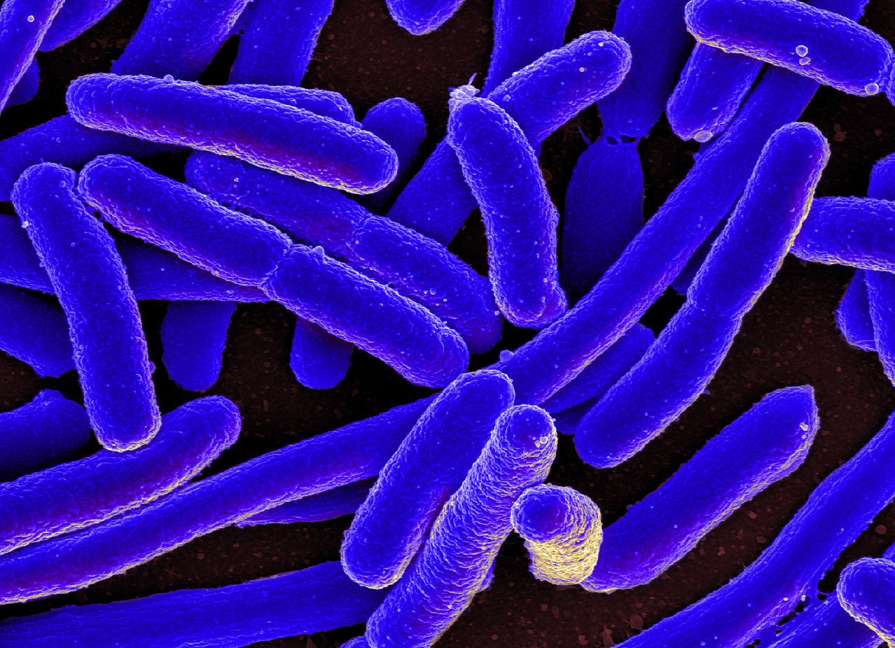 E. Coli Outbreak Raises Worries About Infection Spreading Further