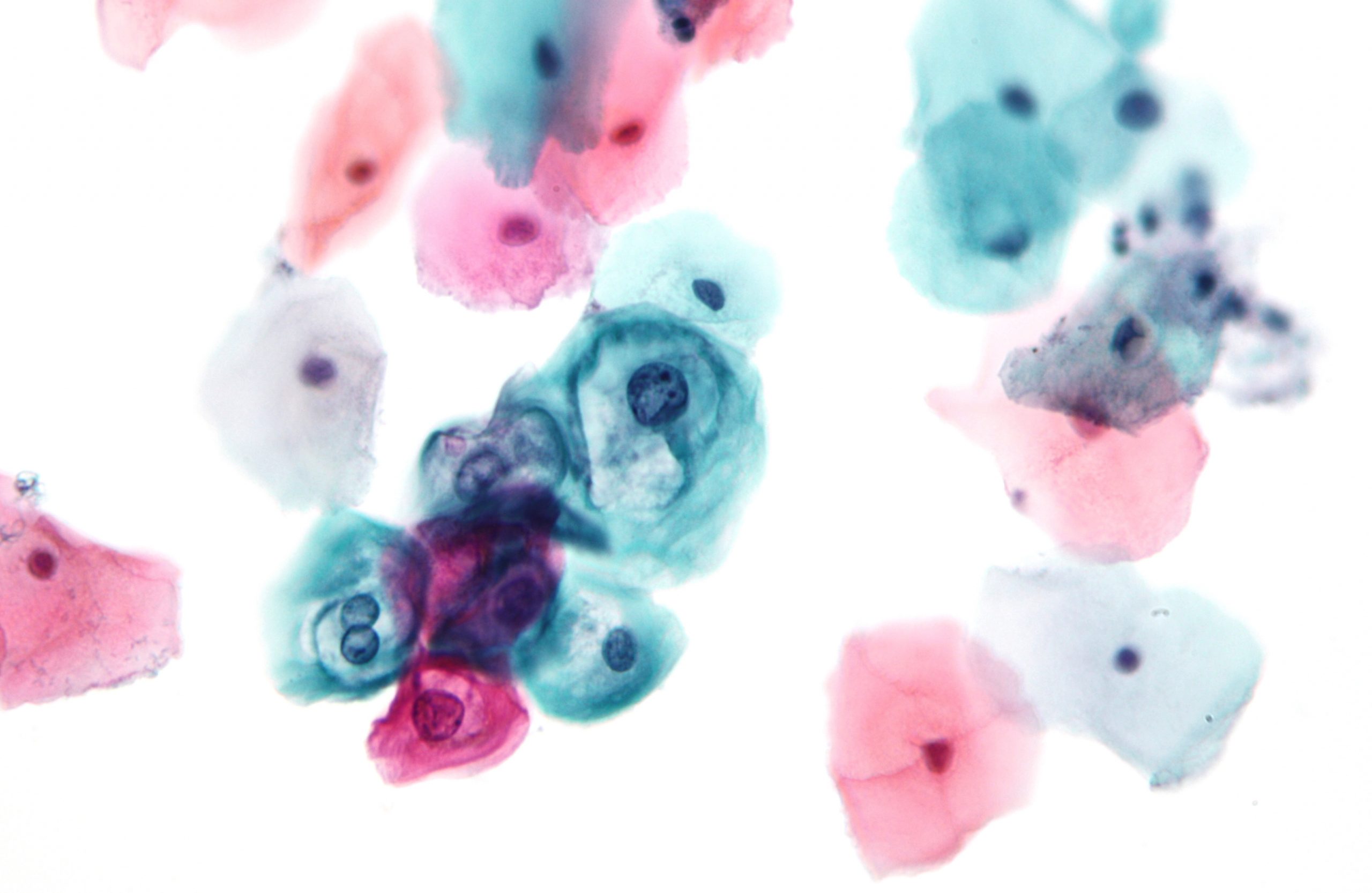 Cervical Cancer Screening Fee To Be Reduced