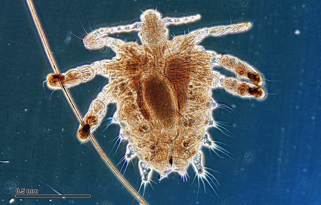 Crab Lice In Iceland Dying Out Due To Loss Of Habitat