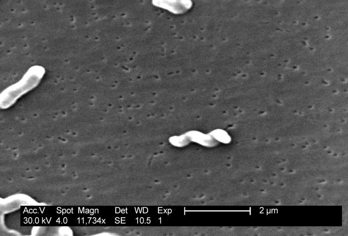 Diarrhoea Outbreak Caused By Campylobacter