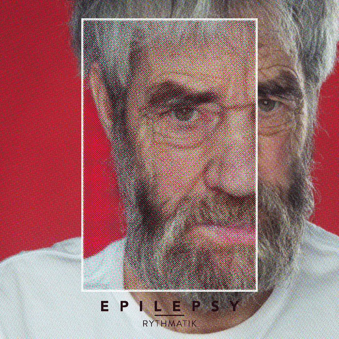 Epilepsy EP